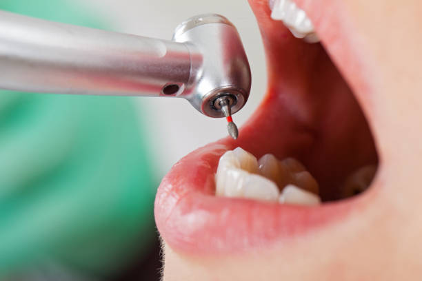 Best Emergency Cosmetic Dentistry in Miramar Beach, FL